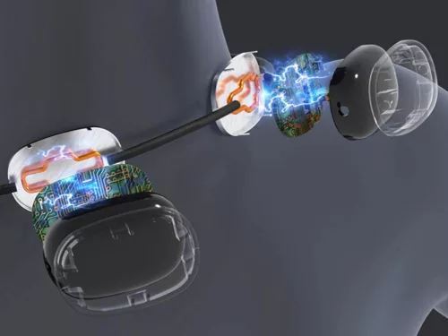 Akkumulátoros elektrostimulációs nyakmasszírozó