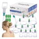 Kínai vákuumos köpölyöző készlet - 12db